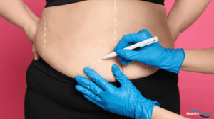 Empowering Lives: The Impact of Bariatric Surgery in Turkey 7